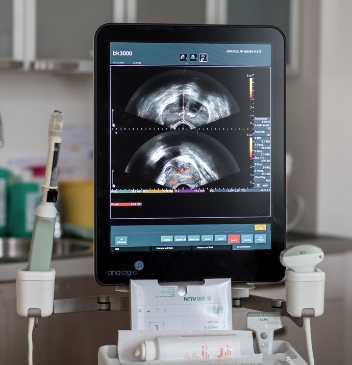 Ultraschallbild einer Prostata